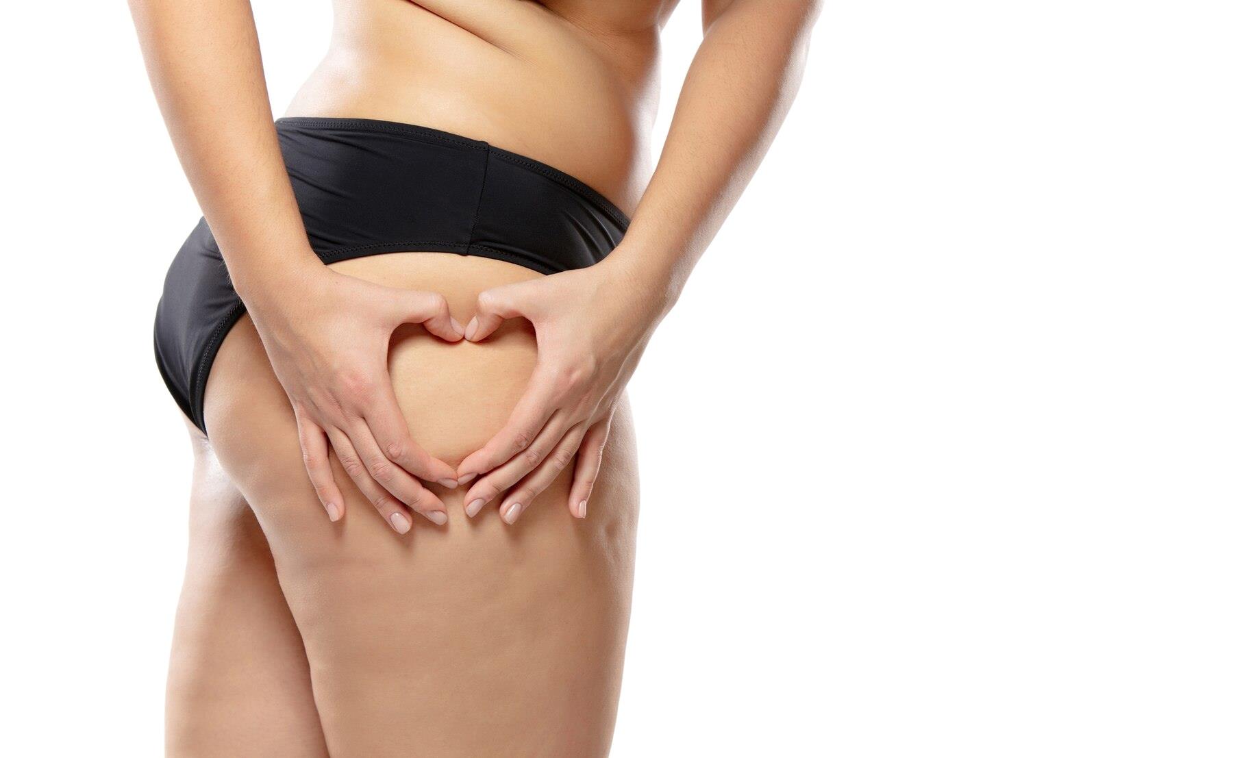 coscia di donna con cellulite